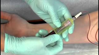 Sample Procedure  Venipuncture Butterfly Method [upl. by Ahsiat400]