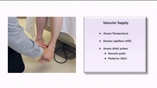 The Diabetic Foot Exam [upl. by Ynnaffit982]