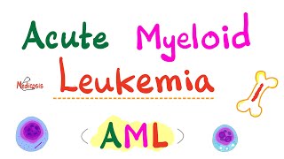 Acute Myeloid Leukemia AML  Auer Rods  Myeloperoxidase Positive  Hematology amp Oncology Series [upl. by Leoine]