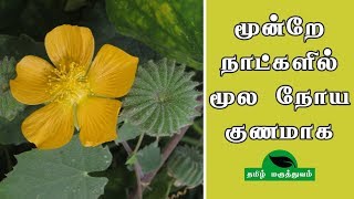 மூன்றே நாட்களில் மூல நோய் குணமாக  Thuthi ilai uses in Tamil  Abutilon Indicum for Piles [upl. by Anchie]