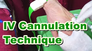 How to Insert IV Cannula  IV Cannulation Technique  Branula  Intravenous Catheter [upl. by Pedersen623]