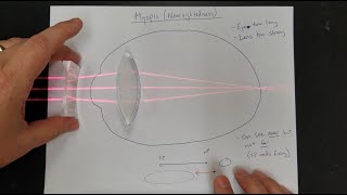 Vision Correction Normal Eyes Myopia Hyperopia Near amp Far Point Lens Power [upl. by Radbourne]