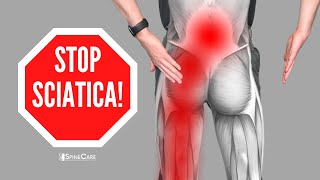 How to Relieve Sciatica Pain in SECONDS [upl. by Aicerg]