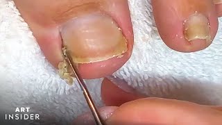 How Toenails Are Professionally Cleaned [upl. by Annaya]