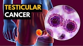 Testicular Cancer Causes Signs and Symptoms Diagnosis and Treatment [upl. by Stedman644]