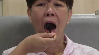 Dysphagia Exercises and Speech Therapy [upl. by Sugihara59]