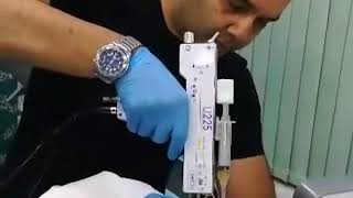 U225  PRP Mesotherapy Injection Gun [upl. by Agneta]