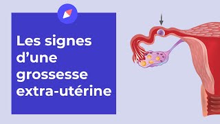 Grossesse extrautérine  les signes à connaître [upl. by Barron]