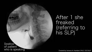 Managing Dysphagia – Thickening Liquids [upl. by Ury]