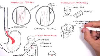 Foregut Development Esophagus amp Stomach – Embryology  Lecturio [upl. by Sirenay]