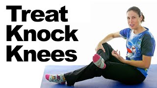 Treat Knock Knees with Easy Stretches amp Exercises [upl. by Willdon721]