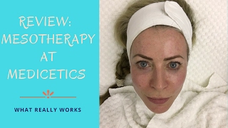 Review of Mesotherapy treatment at Medicetics clinic [upl. by Anizor420]