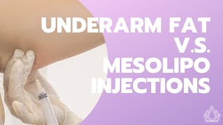 Melt Underarm Fat with Mesotherapy  O2 Skin Lab BGC [upl. by Nicholle]