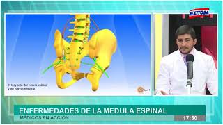 Enfermedades de la médula espinal [upl. by Whelan498]