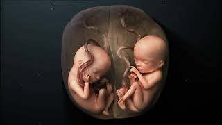 Twins pregnancy week by week जुड़वा बच्चे क्यों होते हैं [upl. by Fahy]