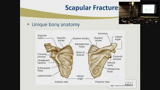 Lateral Clavicle  Dislocations and Fractures  The LCP Clavicle Hook Plate [upl. by Novoj]