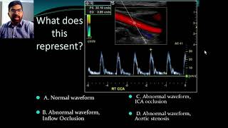 Bronchial and Vesicular Breath Sounds [upl. by Micky]