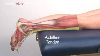 Achilles Tendonitis  Tendinopathy  Explained in 90 Seconds [upl. by Mayberry]