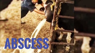 BEST ABSCESS COMPILATION [upl. by Eldwon]