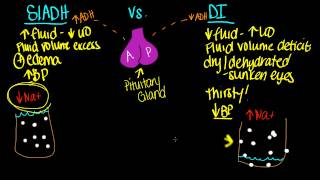 SIADH vs DI [upl. by Merrily456]