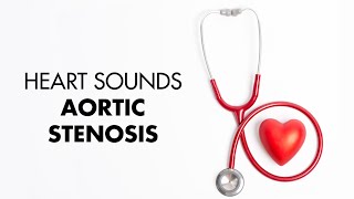 Understanding Your Carotid IMT Ultrasound Report [upl. by Fachini]