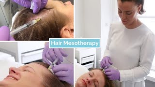 Hair Loss Mesotherapy  The Laser and Skin Clinic [upl. by Neff49]