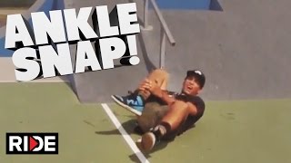 ANKLE SNAP Skateboarding Slam  Alex Curtis [upl. by Eicul25]