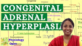 Congenital adrenal hyperplasia  Adrenogenital syndrome  CAH disease  mbbs lectures [upl. by Xonel]