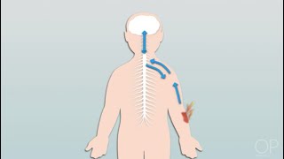 Pathophysiology of Pain by C Dowling  OPENPediatrics [upl. by Nellad]