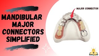 Mandibular Major Connectors  Removable Partial Denture RPD [upl. by Nahtannoj]