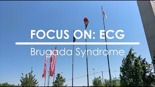 Focus on ECG Brugada syndrome [upl. by Richlad]