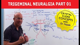 Trigeminal Neuralgia pain attack [upl. by Septima]