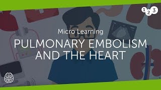 Pulmonary embolism and the heart [upl. by Sewell]