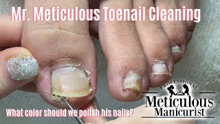 Shortn Sweet  Mr Meticulous Satisfying Impacted Toenail Cleaning [upl. by Joris64]