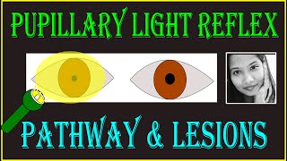 Pupillary Light Reflex – Pathway amp Lesions  Neuro ophthalmology [upl. by Hakkeber]