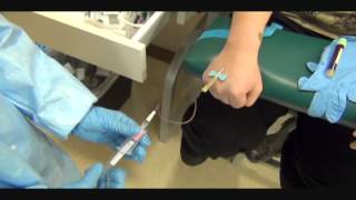 Butterfly Hand Phlebotomy Outside Vein Activationwmv [upl. by Aicitel149]