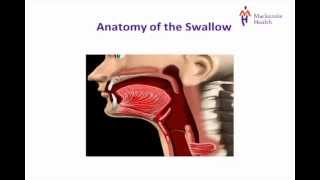 Stroke Education  Dysphagia [upl. by Acir]