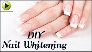 How to Whiten Your Nails Naturally [upl. by Corby427]