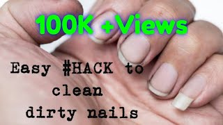 Nail Cleaning  how to remove dirt from nails easyhack [upl. by Rucker111]