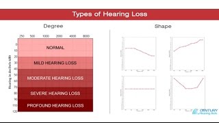 2 Types of Hearing Loss [upl. by Freiman]