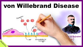 VON WILLEBRAND DISEASE Pathophysiology Clinical Findings Diagnosis Treatment [upl. by Anadroj]