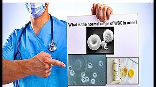 WBC in Urine  High Count Causes [upl. by Market967]