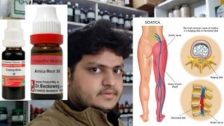 homeopathic medicine for treatment of sciatica explain [upl. by Onaicram]